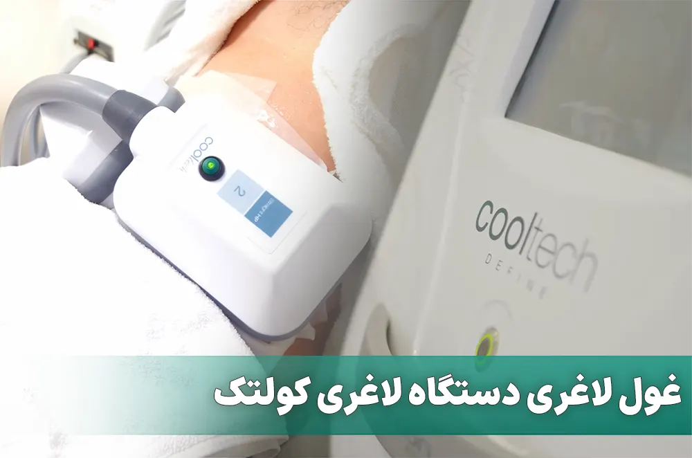 کرایولیپولیز