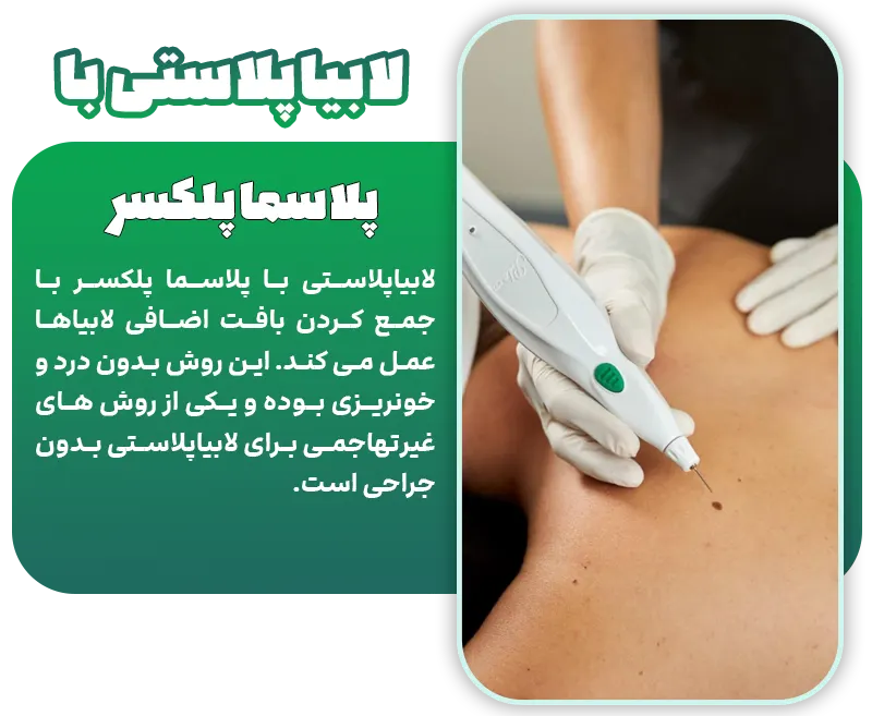 لابیاپلاستی با پلاسما پلکسر