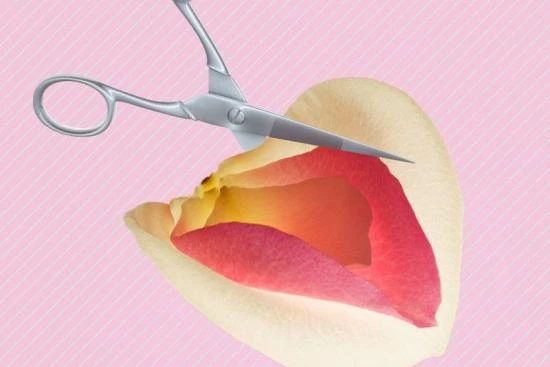 لابیاپلاستی