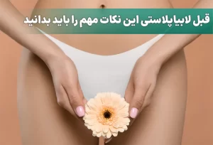 لابیاپلاستی