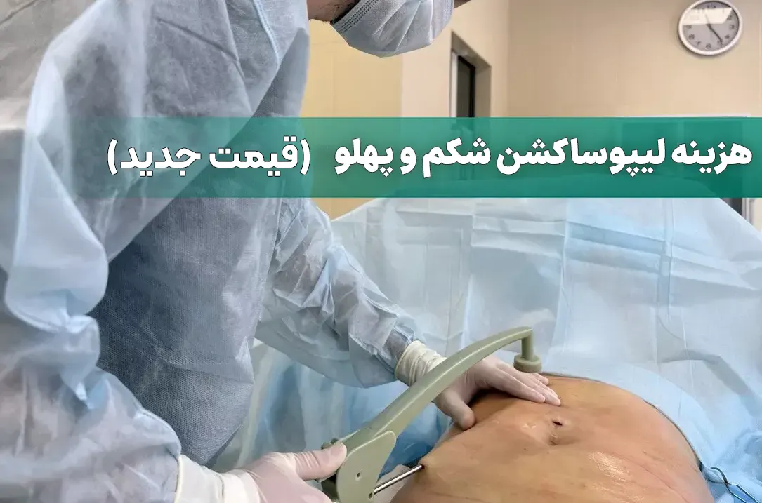 هزینه لیپوساکشن شکم و پهلو