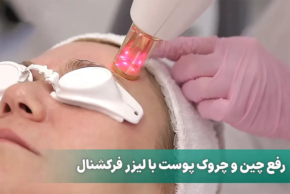 رفع چین و چروک پوست با لیزر