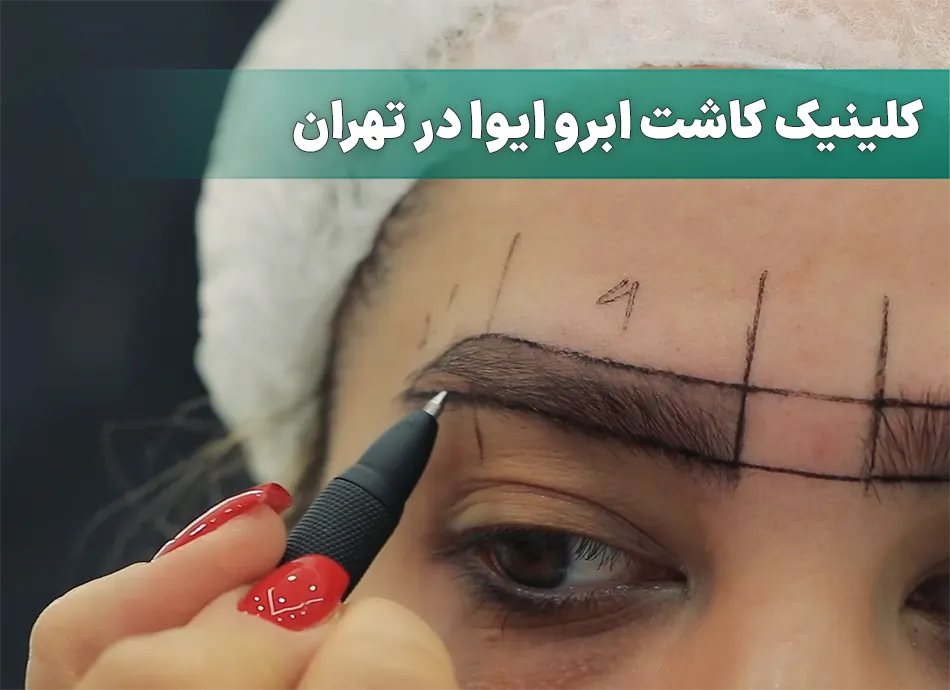 کلینیک کاشت ابرو ایوا در تهران
