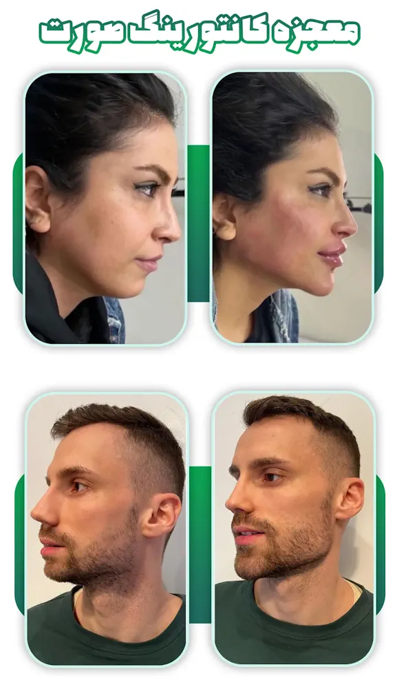 کانتورینگ صورت