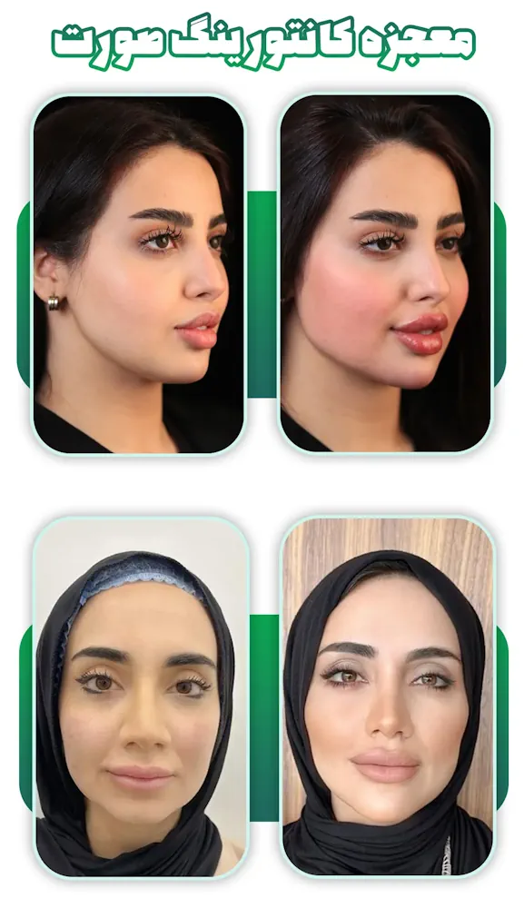 کانتورینگ صورت