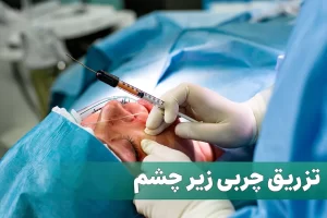 تزریق چربی زیر چشم