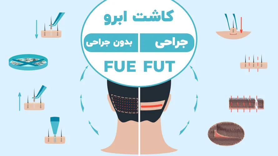 انواع روش های کاشت ابرو