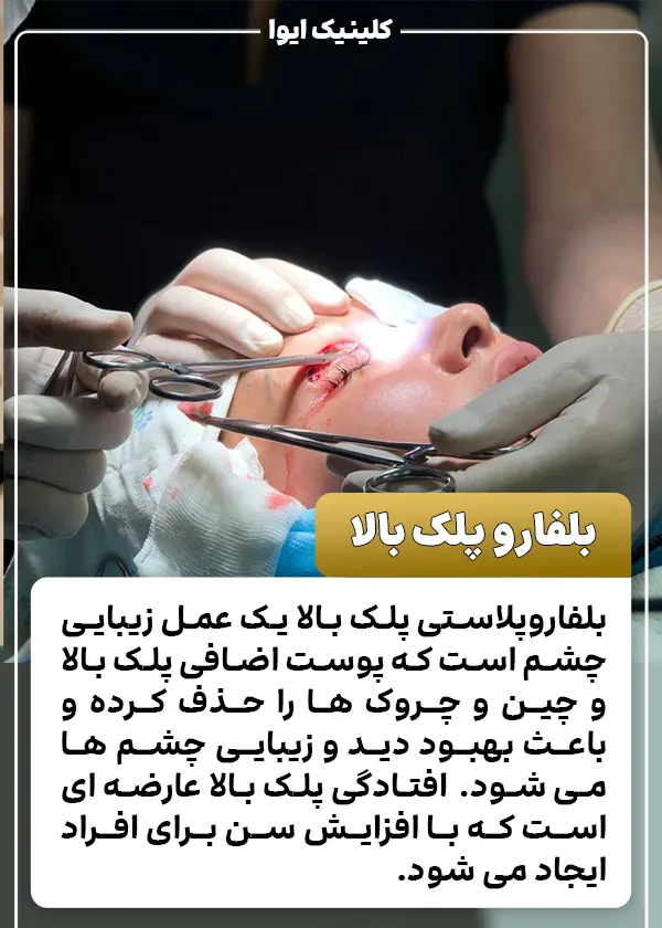 بلفاروپلاستی پلک بالا چیست؟