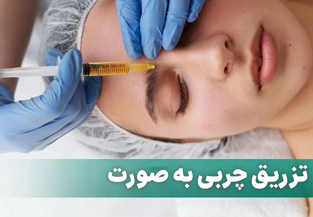 تزریق چربی به صورت