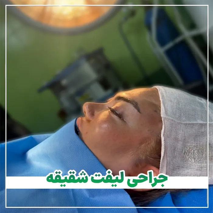 لیفت شقیقه جراحی