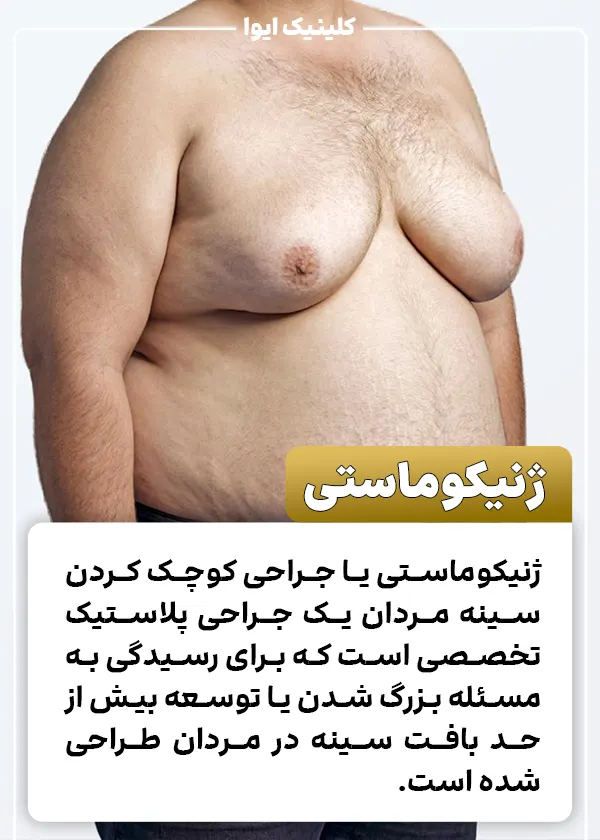 جراحی ژنیکوماستی
