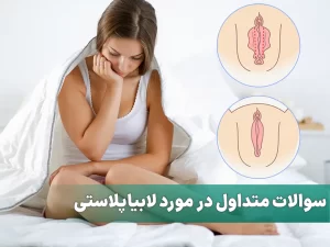 سوالات متداول در مورد لابیاپلاستی