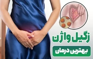 زگیل واژن