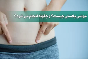 مونس پلاستی