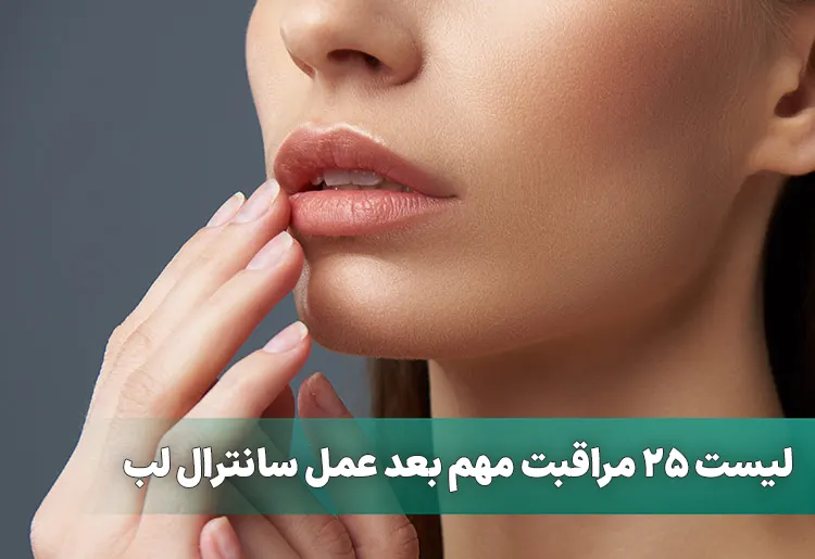 مراقبت مهم بعد عمل سانترال لب