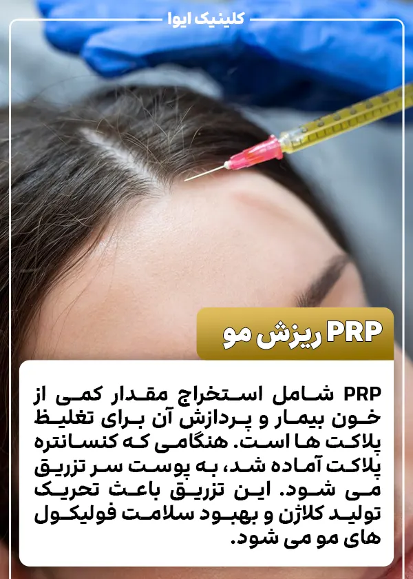 درمان ریزش مو با پلاسما خون یا prp