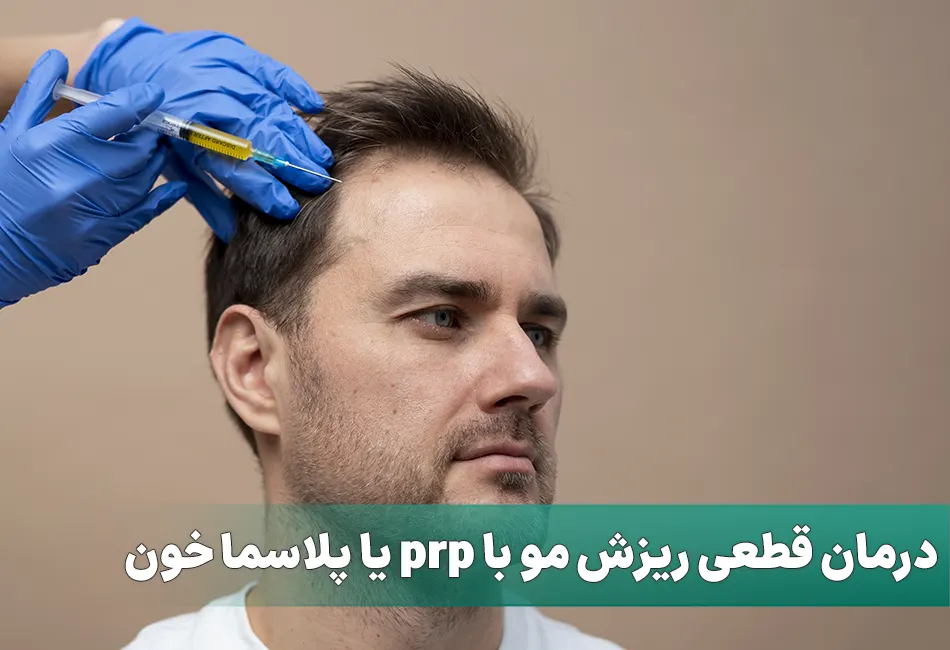 درمان قطعی ریزش مو با prp