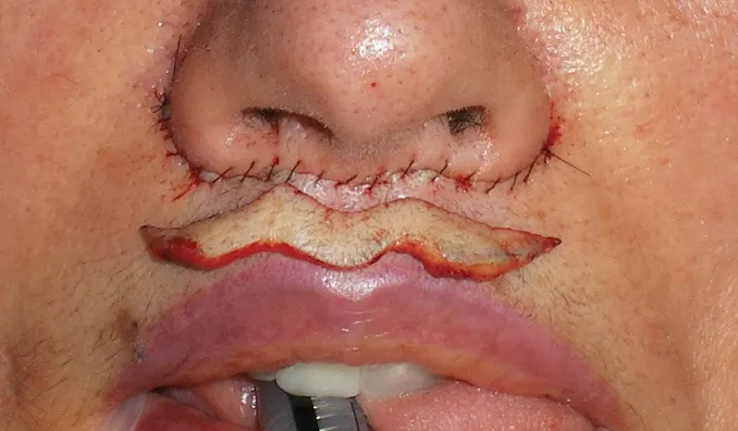 سانترال لب چیست