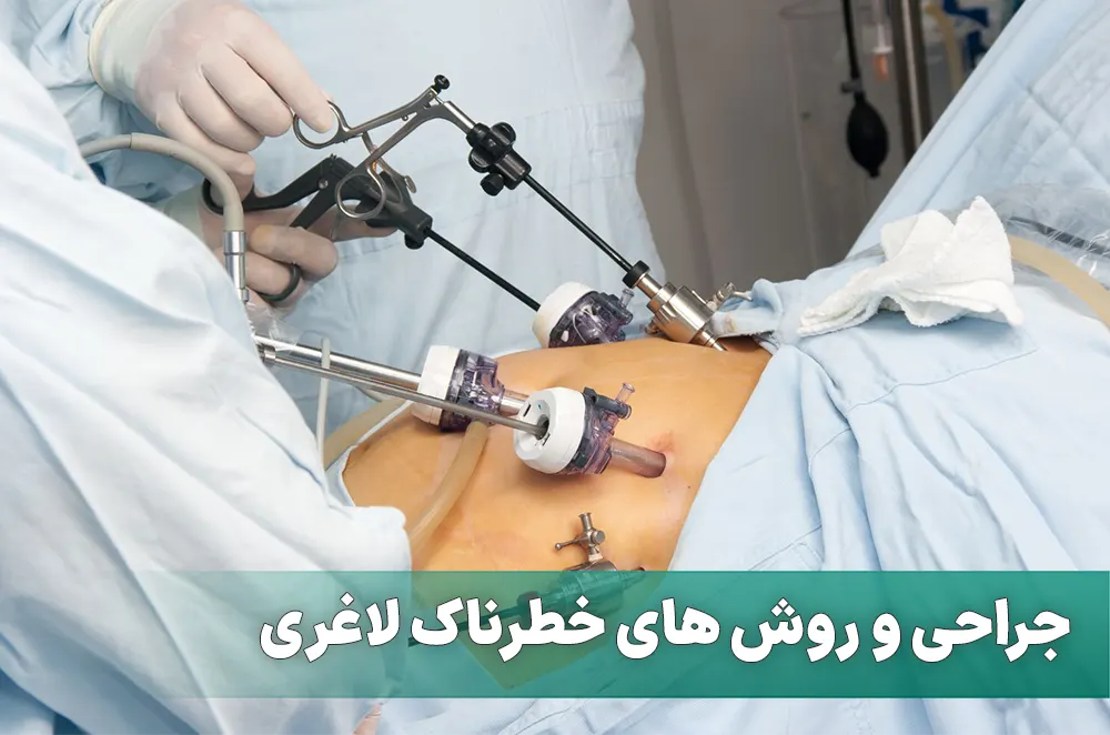 کدام روش های لاغری خطرناک است؟