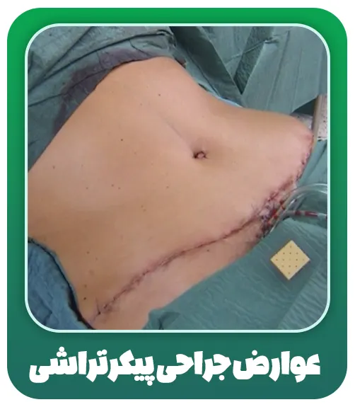 عوارض جراحی پیکرتراشی