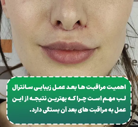 مراقبت بعد عمل سانترال لب