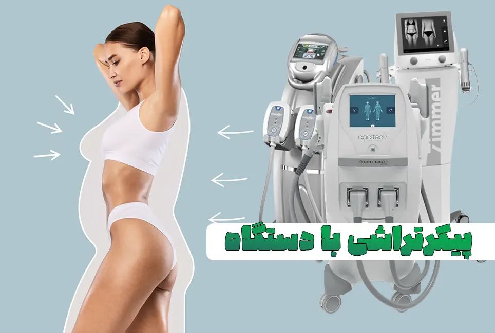 پیکرتراشی با دستگاه