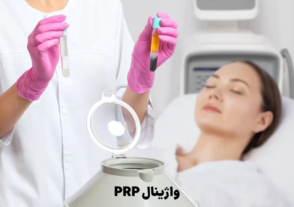 PRP واژینال