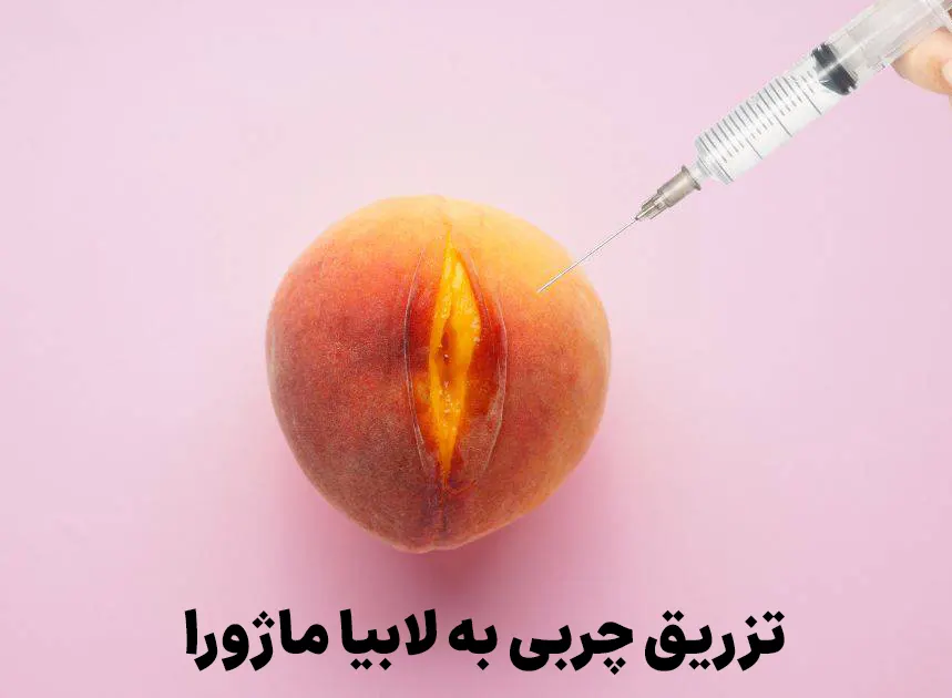 تزریق چربی به لابیا ماژورا