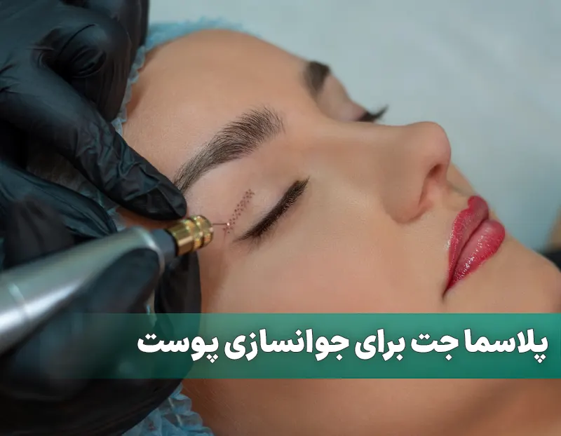 پلاسما جت برای جوانسازی پوست