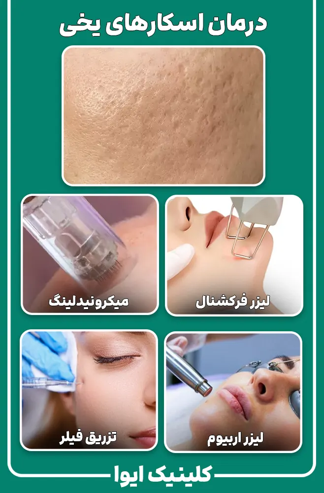 اسکارهای جعبه‌ای