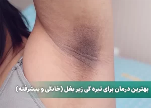 بهترین درمان برای تیره گی زیر بغل (خانگی و پیشرفته)