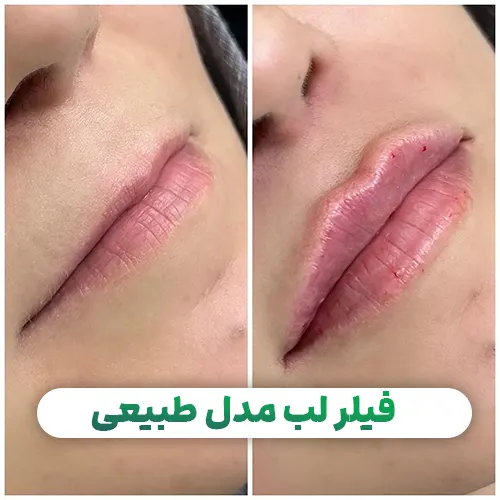 مدل لب طبیعی