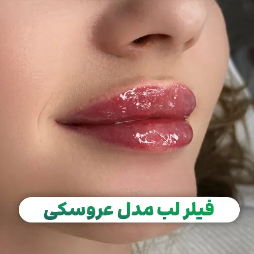 فیلر لب مدل عروسکی