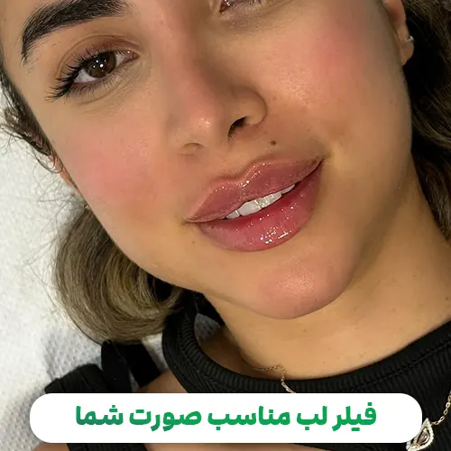 فیلر لب مناسب صورت شما