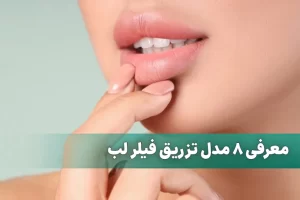 معرفی 8 مدل تزریق فیلر لب