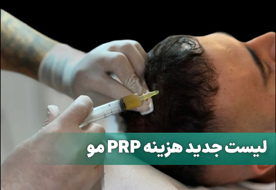 هزینه prp مو سر