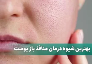 بهترین شیوه درمان منافذ باز پوست