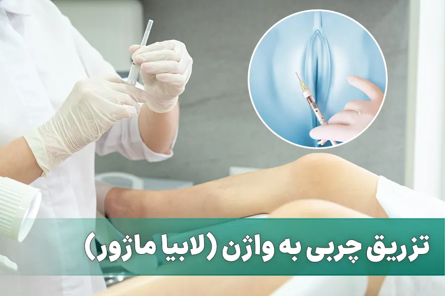 تزریق چربی به واژن
