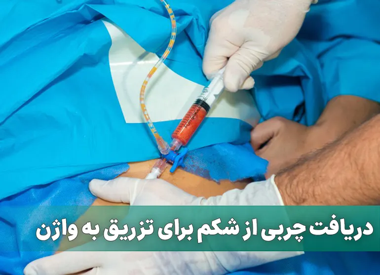 دریافت چربی از شکم برای تزریق به واژن