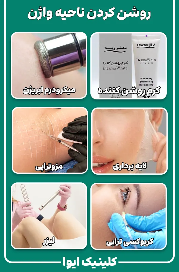 روشن کردن ناحیه واژن