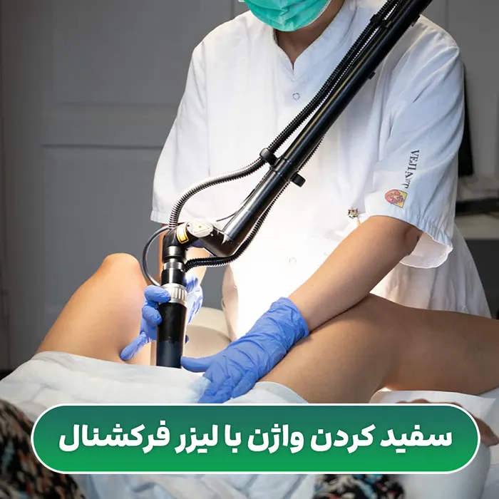 سفید کردن واژن با لیزر فرکشنال