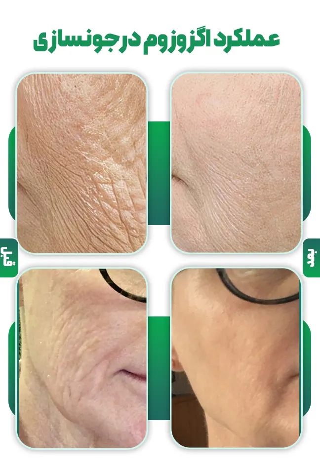 عملکرد اگزوزوم درجوانسازی