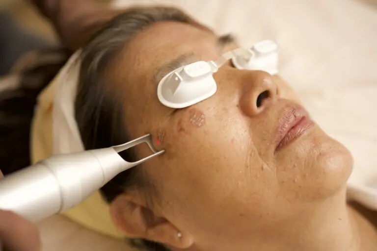 لیزر لک صورت