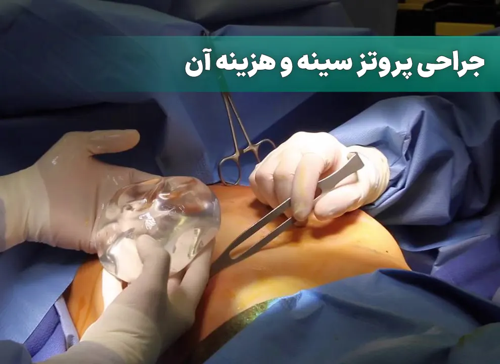 جراحی پروتز سینه و هزینه آن