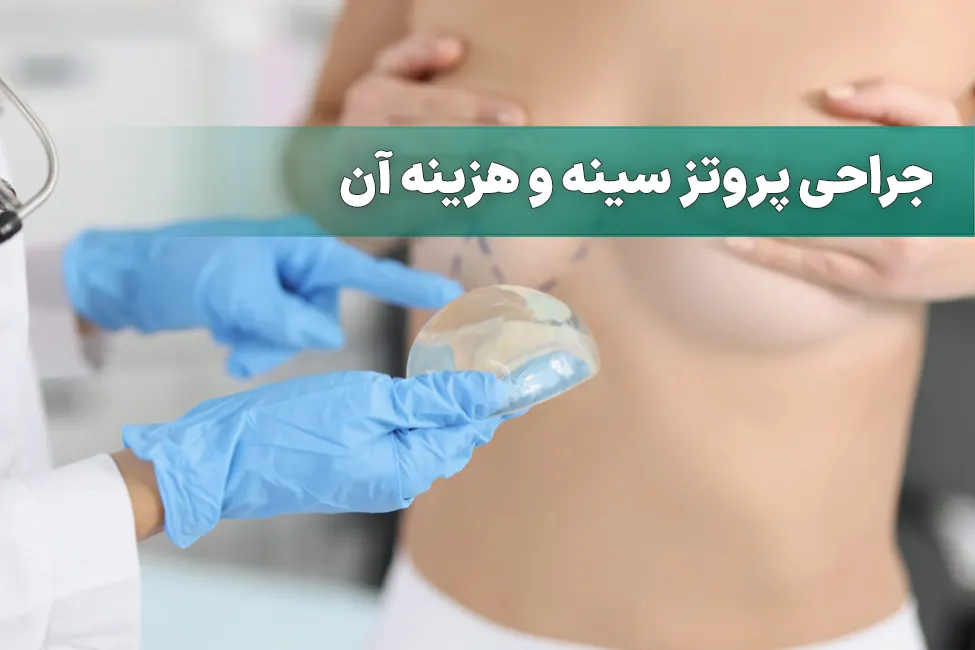 جراحی پروتز سینه و هزینه آن