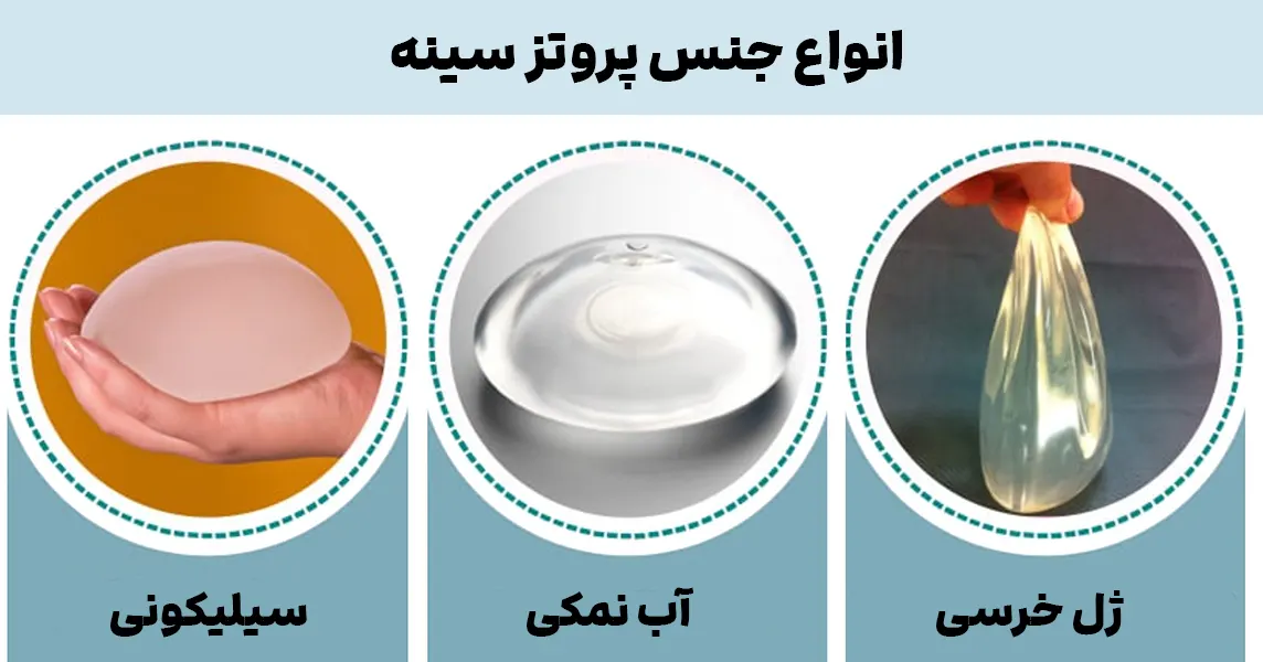 انواع جنس پروتز سینه