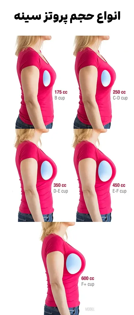 انواه حجم پروتز سینه