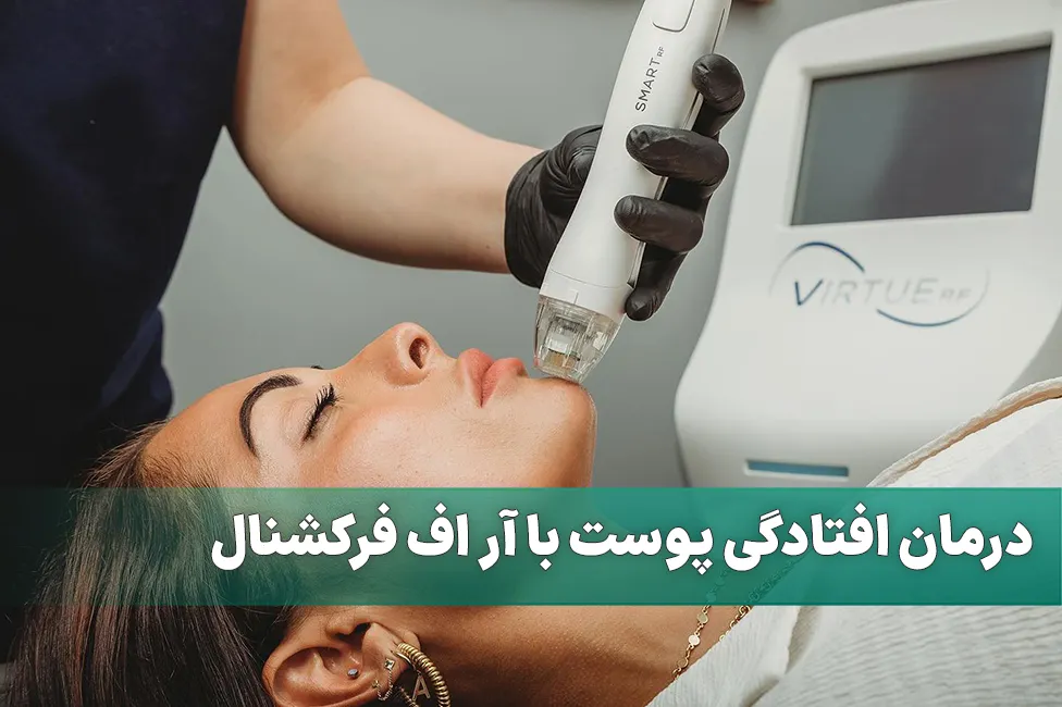 درمان افتادگی پوست با آر اف فرکشنال
