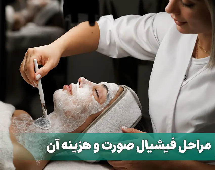 فیشیال صورت