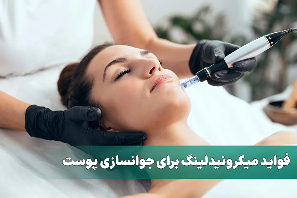 فواید میکرونیدلینگ برای جوانسازی پوست